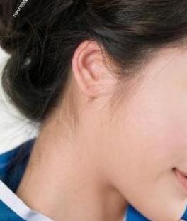 成都哪個(gè)醫(yī)院做耳朵整形效果好？