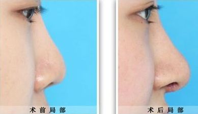 臨汾臻容醫(yī)療美容門診部詳解：技術水平、服務項目與價格清單