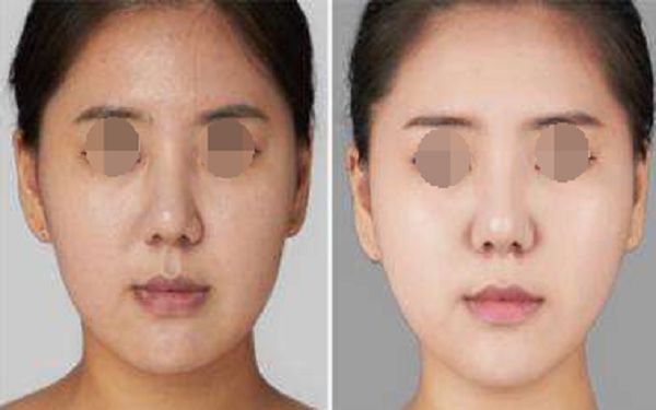 珠海博愛女子醫(yī)院整形外科項目全新推出，項目大揭秘