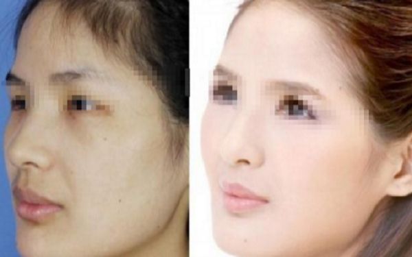 重慶美容整形科室推薦：挑選經(jīng)驗(yàn)豐富的專家最重要