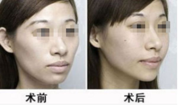 湖北地區(qū)整形醫(yī)院評選榜單，醫(yī)術(shù)高超排名靠前的醫(yī)療機構(gòu)