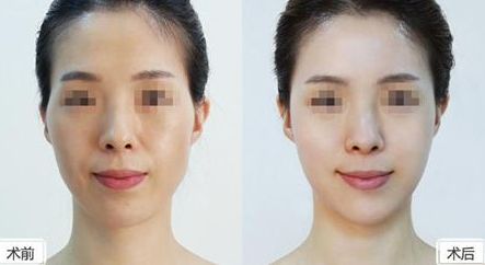 深圳美萊整形醫(yī)院位置介紹，牽手醫(yī)生，搶先體驗(yàn)熱門項(xiàng)目