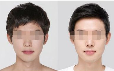 汕頭知名醫(yī)美機構(gòu)排行榜大揭秘，你知道嗎？