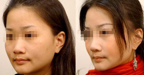 無錫市最好的私密整形醫(yī)院推薦名單