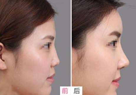 相山愛美爾醫(yī)療美容門診部，多項(xiàng)特色項(xiàng)目亮相，幫助您煥發(fā)美麗