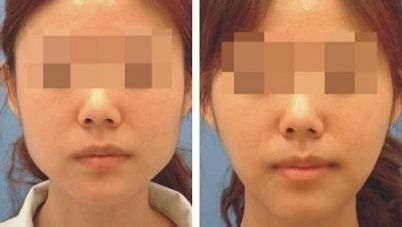 貴陽(yáng)市眼部整形醫(yī)院排行榜