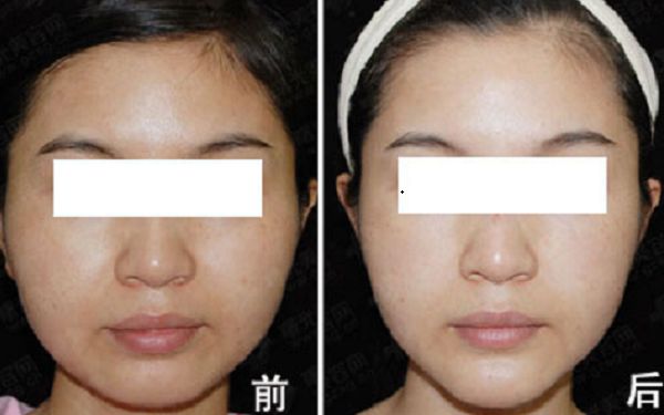 重慶市知名整形美容醫(yī)院榜單出爐！引領(lǐng)時(shí)尚潮流的醫(yī)療機(jī)構(gòu)盤點(diǎn)