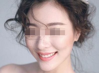 上海十大修復雙眼皮專家排行榜