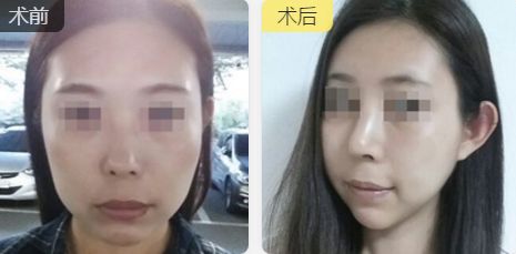 福州中聯(lián)美康醫(yī)療美容門診部的醫(yī)生技術(shù)及擅長(zhǎng)項(xiàng)目推薦