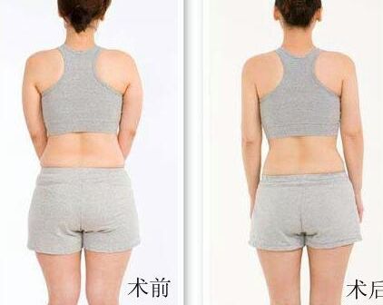 如何讓魚(yú)尾紋立即消失