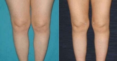 答案：  浙江哪個(gè)醫(yī)院的燒傷整形科醫(yī)護(hù)人員規(guī)模龐大？