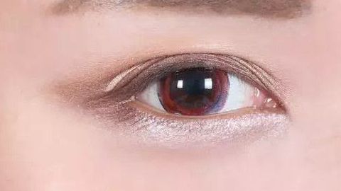 中南大學(xué)湘雅醫(yī)院眼袋整形揭秘：專家團(tuán)隊(duì)、手術(shù)解析