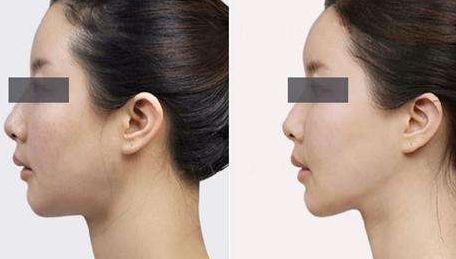 綿陽市哪家醫(yī)院整形效果好？整形醫(yī)院排名榜前十名出爐！