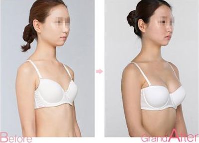 成都祛斑醫(yī)院排名前八，告訴你哪家靠譜