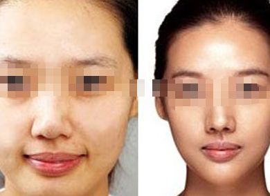 女星蠟像面容成災(zāi)，孫菲菲領(lǐng)銜瘦臉狂潮