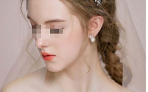 嘉興哪家美容醫(yī)院效果好