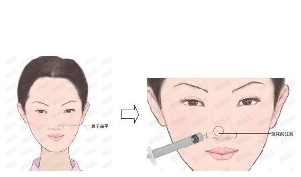 邯鄲萊媚儷整形：價格實惠，專業(yè)修復，雙眼皮、隆鼻等項目詳解！