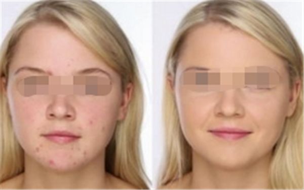 額頭飽滿與個人命運：科學(xué)解讀面相學(xué)說