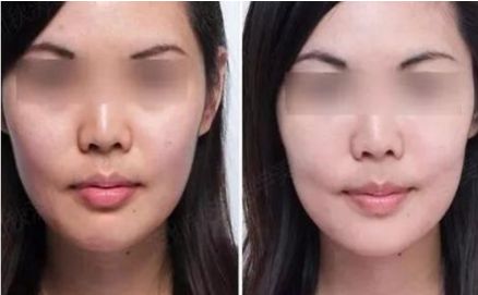 蚌埠最優(yōu)選！第一人民醫(yī)院整形科醫(yī)生名單公開，四月價格表持續(xù)更新！