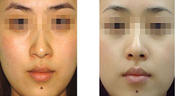 青島市城陽區(qū)吸脂整形醫(yī)院哪家好，用戶評價排名前三