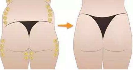 北京雙眼皮價格大全，口碑醫(yī)生推薦，預約指南