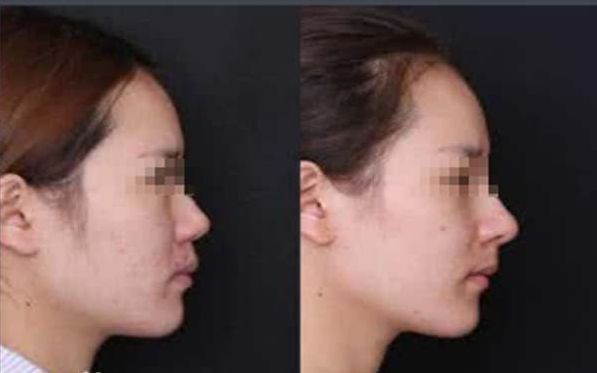 佛山市整形醫(yī)院醫(yī)生資質(zhì)及技術(shù)實力概述