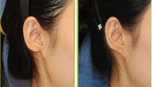 大慶拉皮手術(shù)好口碑醫(yī)院推薦：用戶真實(shí)評(píng)價(jià)分享！