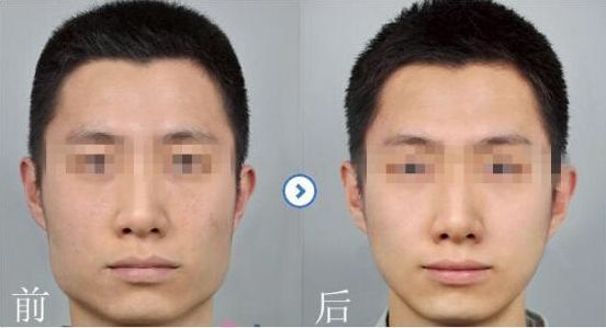 2024寧波注射自體脂肪醫(yī)院排行榜，就在這里發(fā)現(xiàn)比較好的選擇！