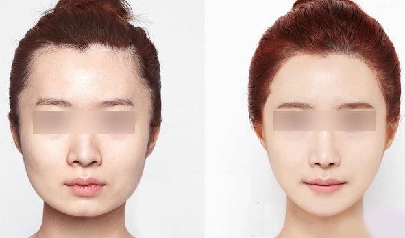 西安藝星醫(yī)療美容醫(yī)院2023年價格一覽：了解醫(yī)療美容服務(wù)費用信息，醫(yī)生簡介待查！