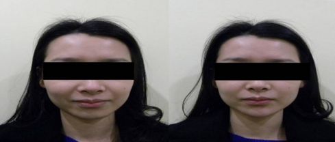 優(yōu)質整形醫(yī)院排行榜，找哪家吸脂效果好？