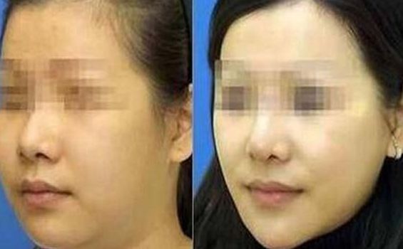 西昌愛(ài)麗諾醫(yī)療整形美容醫(yī)院綜合實(shí)力如何