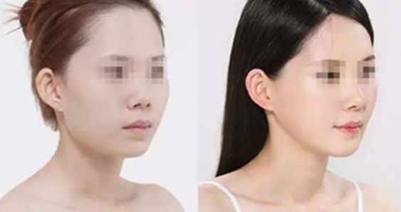 解答：重塑青春，重?zé)ㄈ蓊?！上海時(shí)光整形外科醫(yī)院，專業(yè)修復(fù)美麗，為您點(diǎn)亮自信！