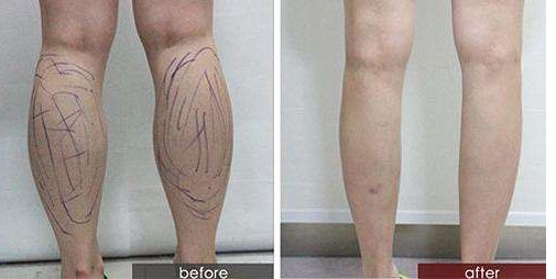 【濰坊博雅整形：醫(yī)生推薦、價(jià)格透明】