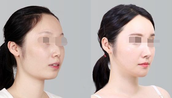 浙江整形外科醫(yī)院排行榜出爐，引領(lǐng)美麗新風(fēng)尚！