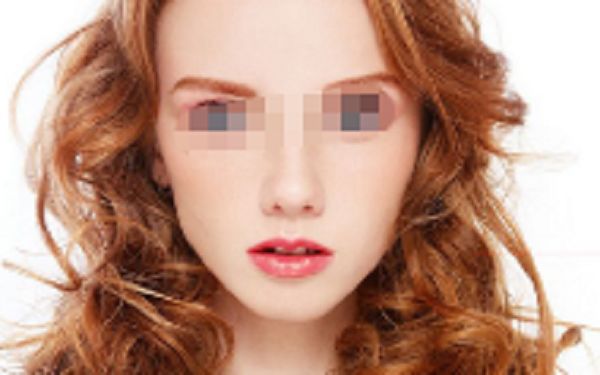 衢州哪家醫(yī)院割雙眼皮效果好？