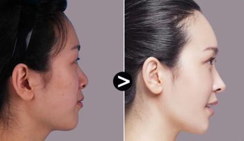 西安哪家整形醫(yī)院匯總排名前十？專業(yè)權(quán)威醫(yī)院推薦！