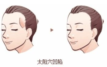 成都整形醫(yī)院排名前十名單整理，銅雀臺(tái)、米蘭柏羽何居首？