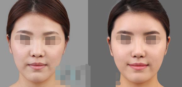 長(zhǎng)春市更受歡迎的整形醫(yī)療機(jī)構(gòu)揭曉