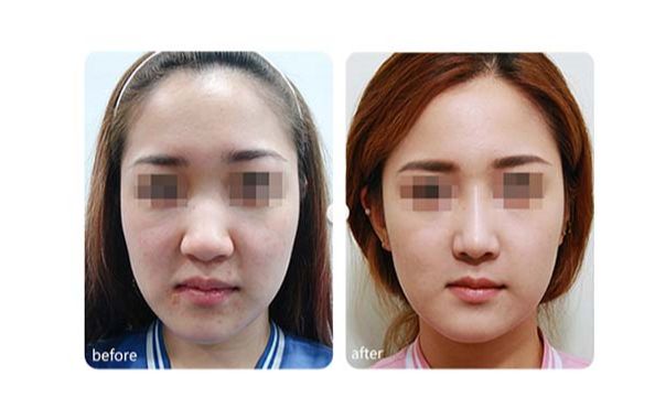 廣州優(yōu)質(zhì)磨骨整形醫(yī)院推薦！TOP10醫(yī)療機(jī)構(gòu)揭秘