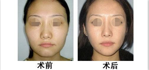 蘭州有哪些專業(yè)整形醫(yī)院值得去？