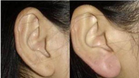 河南耳朵再造醫(yī)院排名榜單：鄭州南陽最佳耳部整形醫(yī)院盤點