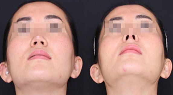 重慶哪家整形醫(yī)院口碑好？專業(yè)整形醫(yī)院推薦匯總