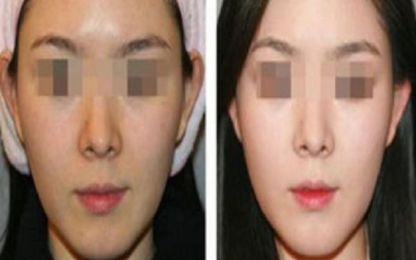 銅陵博愛醫(yī)院醫(yī)療美容科，專業(yè)醫(yī)生技術(shù)如何？