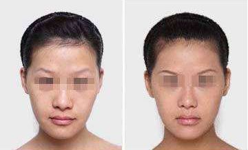 沙醫(yī)生整形大連收費(fèi)揭秘！院內(nèi)價(jià)格表詳解，看看整形費(fèi)用是否貴？