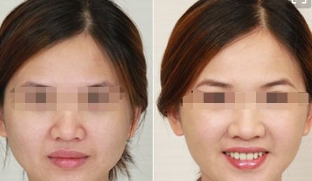 經(jīng)期護(hù)膚指南：讓美麗與周期同行