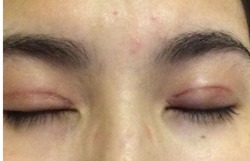 2024年臺州市頂尖整形醫(yī)院排行榜發(fā)布，震撼推薦臺州名列前茅的醫(yī)療機構(gòu)！