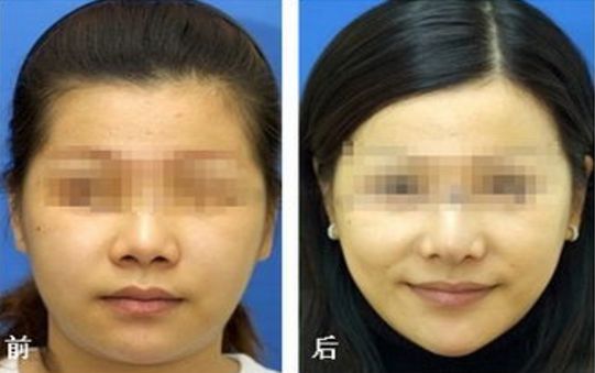 廣東美恩整形美容醫(yī)院口碑揭秘：地址、醫(yī)生評價指南