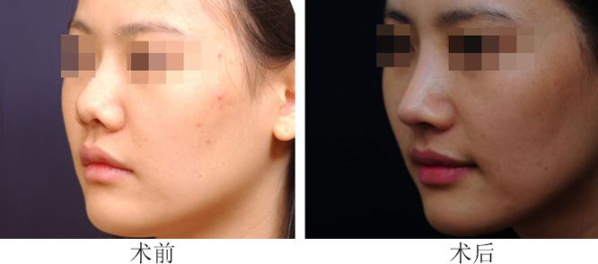 長(zhǎng)春哪家整形醫(yī)院口碑年度最佳，排名比較好