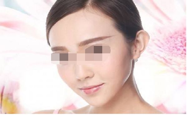 北京碧蓮盛發(fā)際線種植技術(shù)怎么樣？