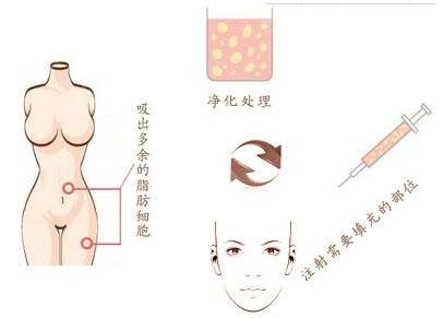 南通鼻整形實(shí)力強(qiáng)勁醫(yī)院盤點(diǎn)：專業(yè)醫(yī)師，打造精致鼻型